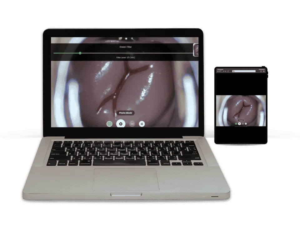 Griva Vision software dashboard exhibiting pristine 2K high-resolution medical imaging on a connected screen